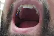 What is this thing the dentist stuck in my tooth during a root canal?