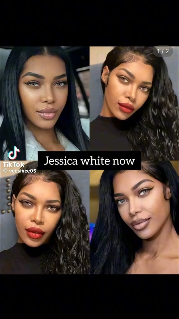 Jessica White skin bleaching?