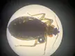 A bed bug under a microscope