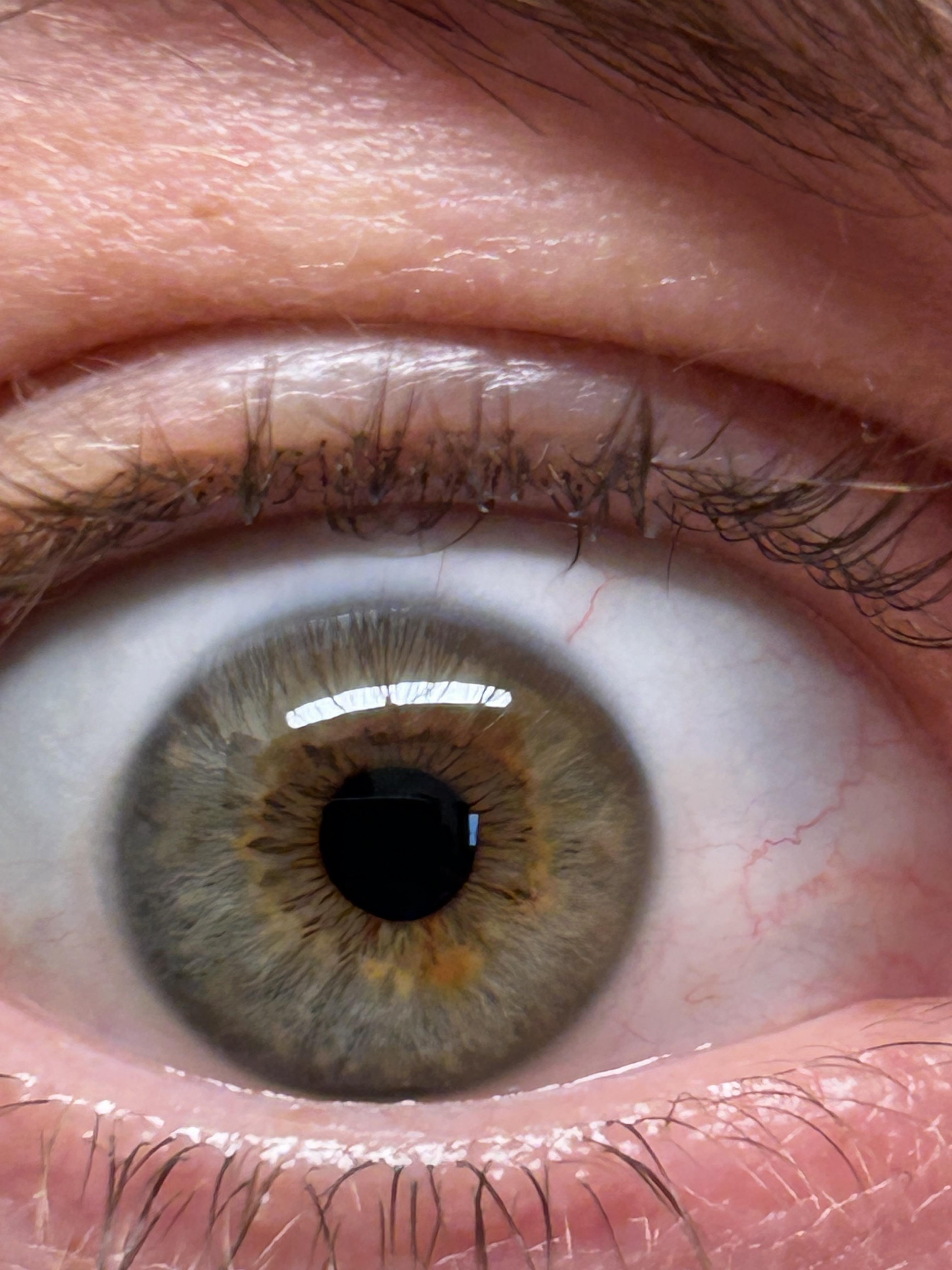 This a normal eye color? Common?