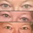 Bipolar eyes 