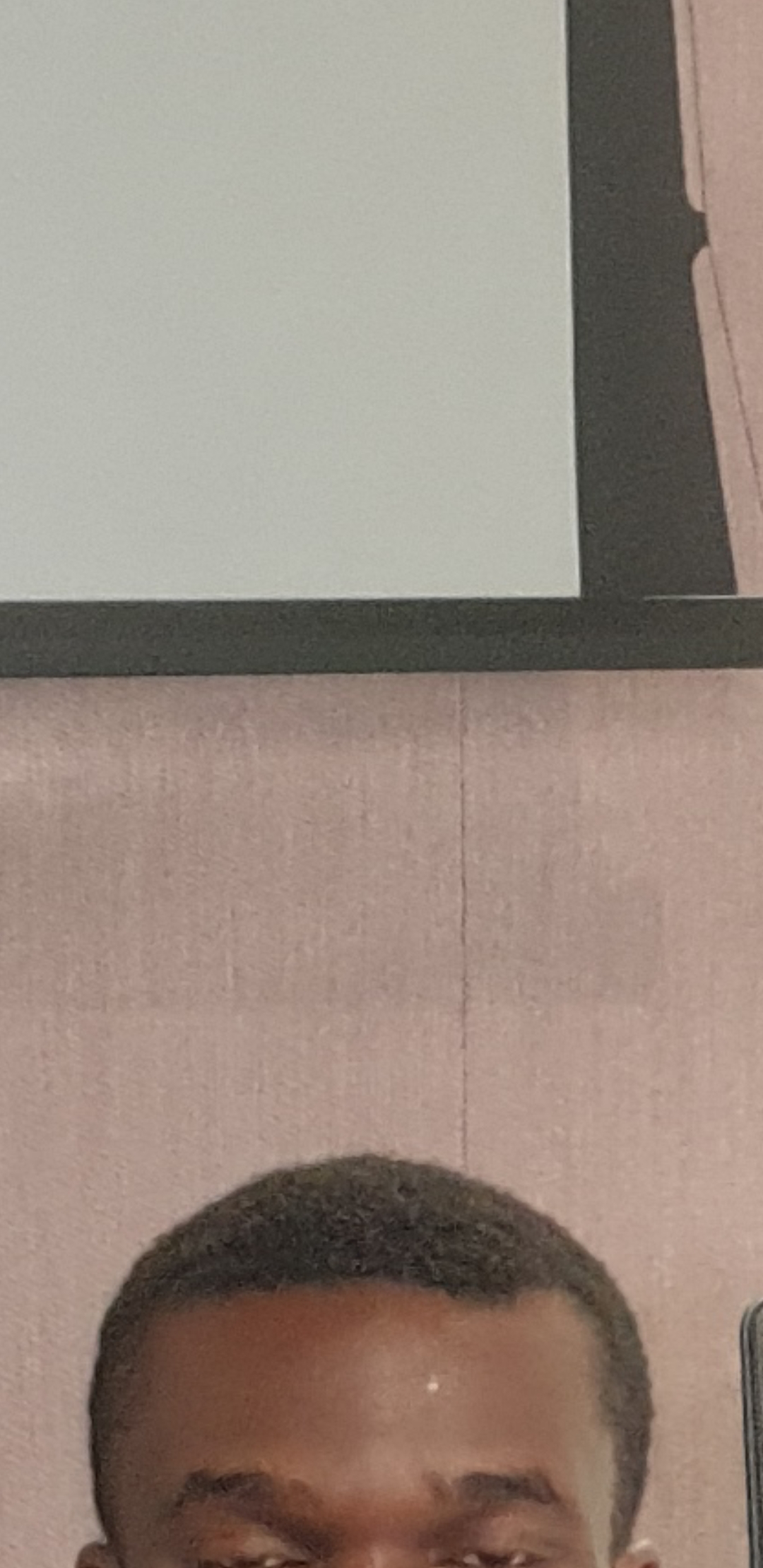 Please can someone tell me, why is my hairline like this? I am 21M and