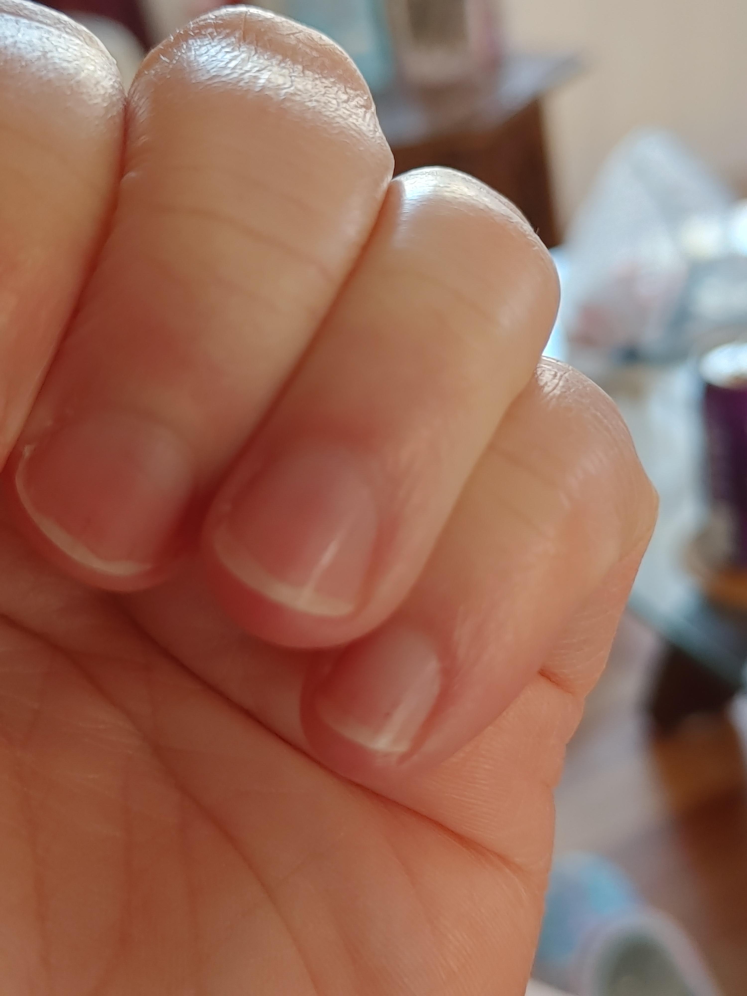 Nails