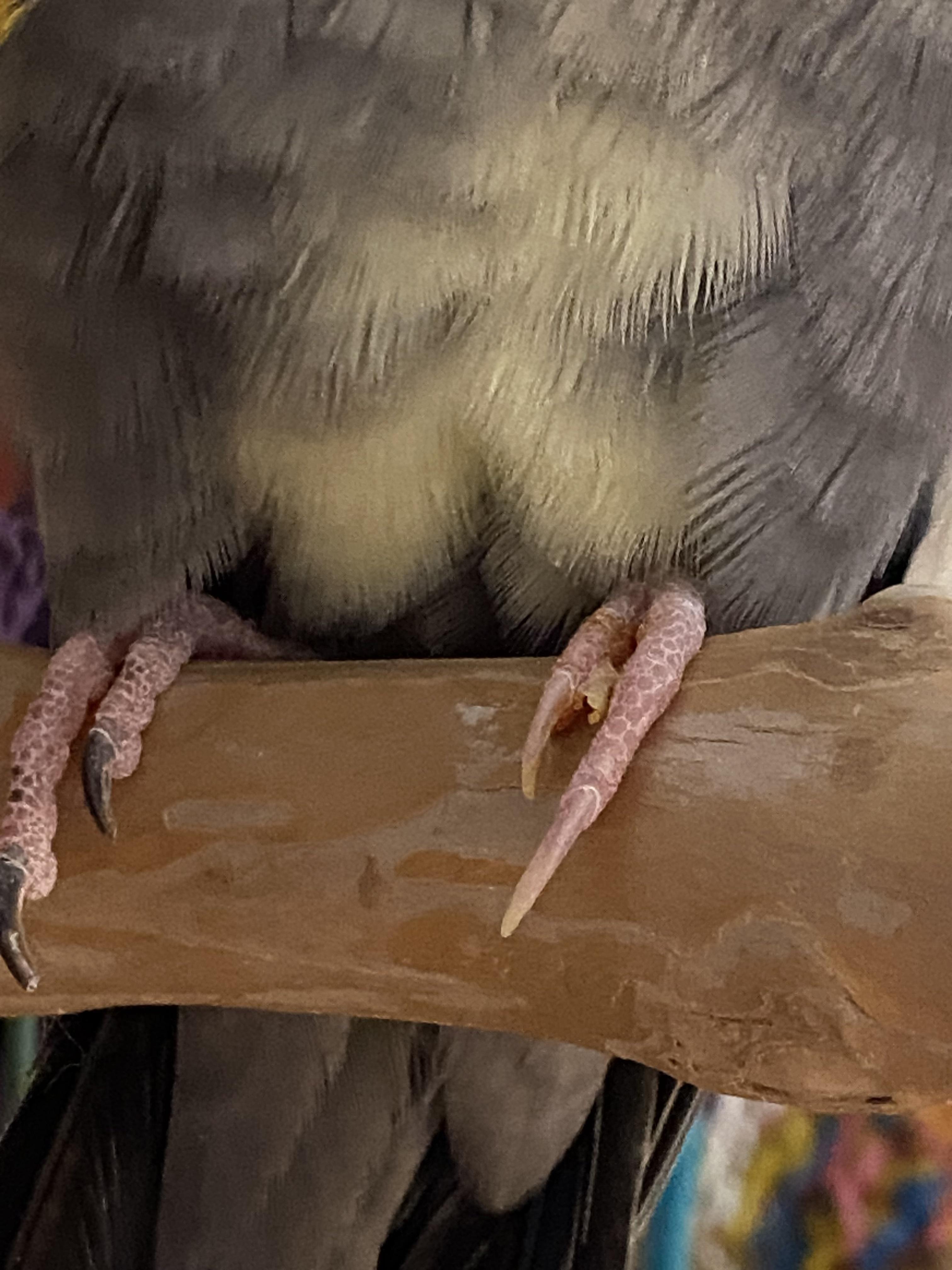 Caring for ripped skin on toe