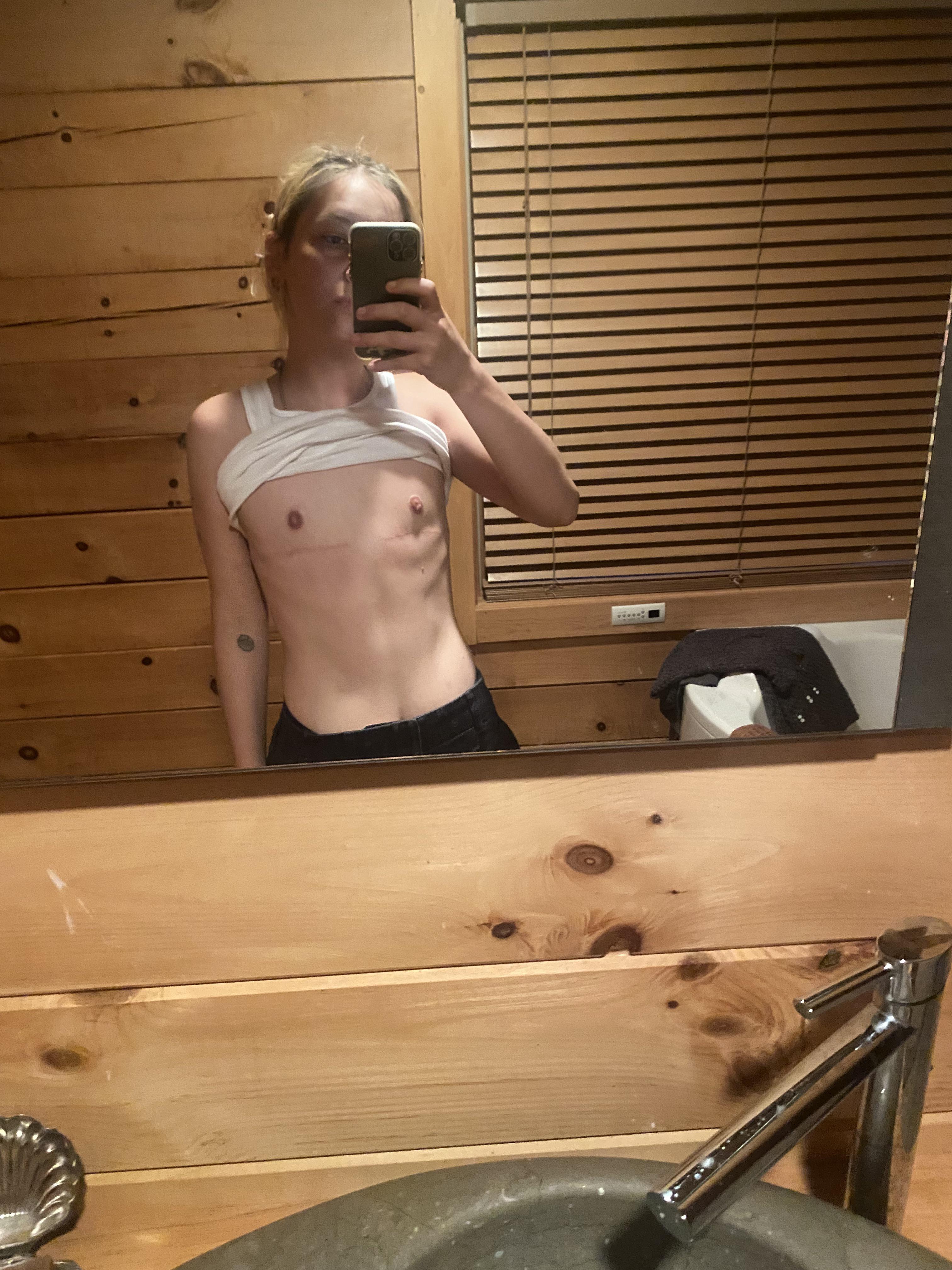 FTM person with blonde hair and a tattoo taking a mirror selfie, lifting a white crop top to show top surgery results