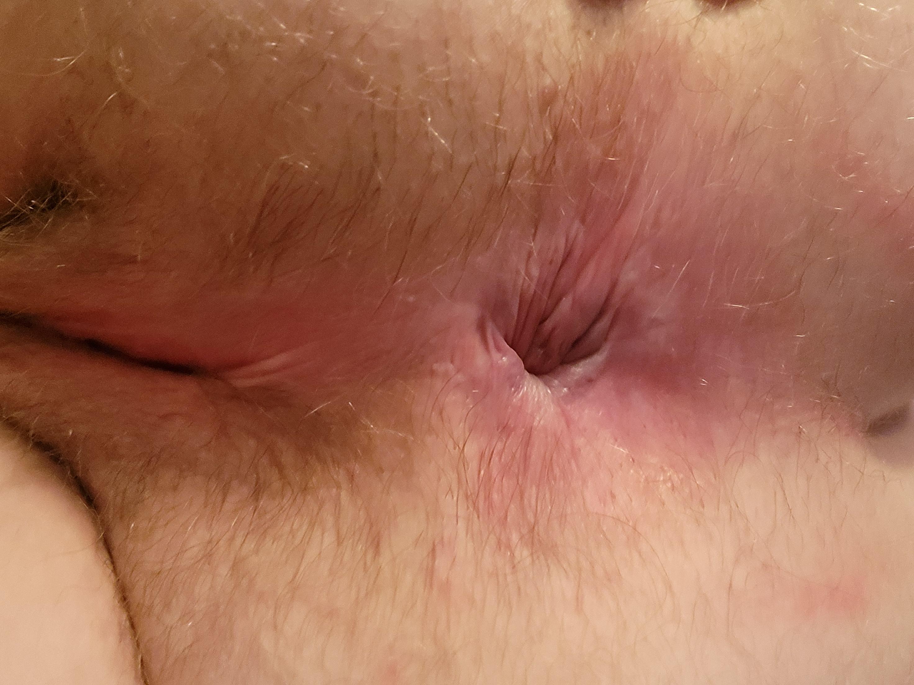 My friend opened my ass up last night