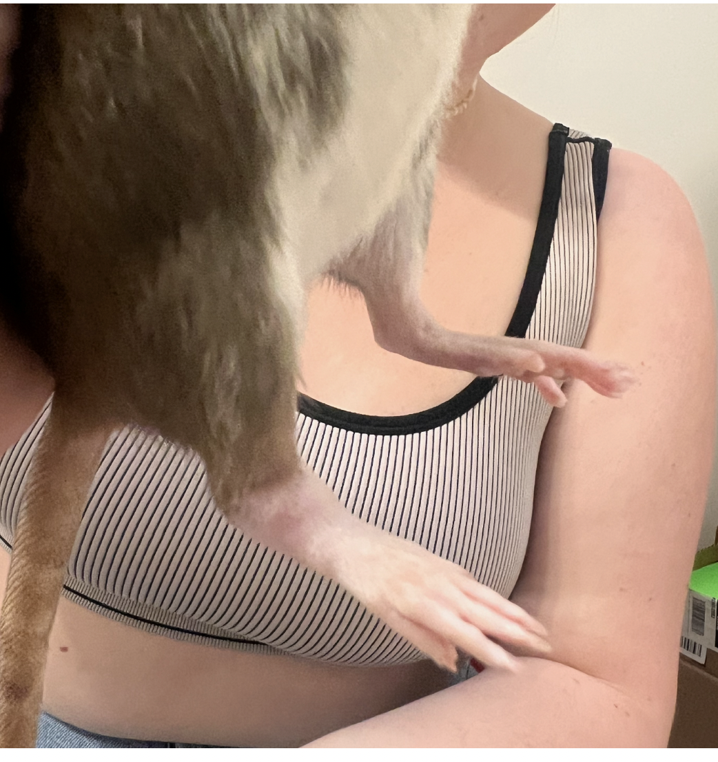 Swollen and purple ankle, but no pain