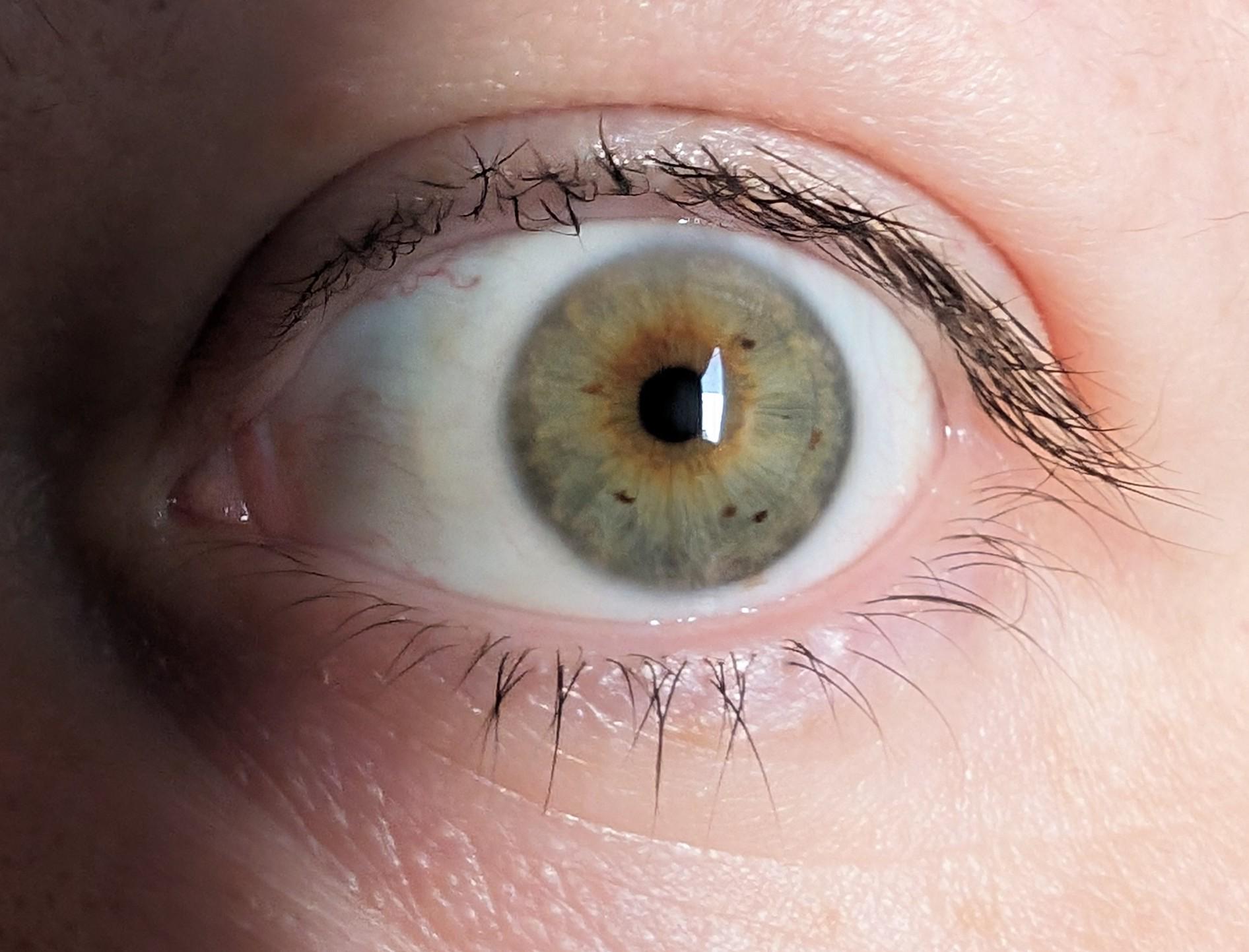 Green eyes with central heterochromia. I was today years old when I realized my eyes are also speckled!