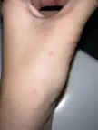Red, itchy bumps