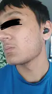 SkincareAddicts