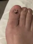Anyone else given their removed big toenail an identity?