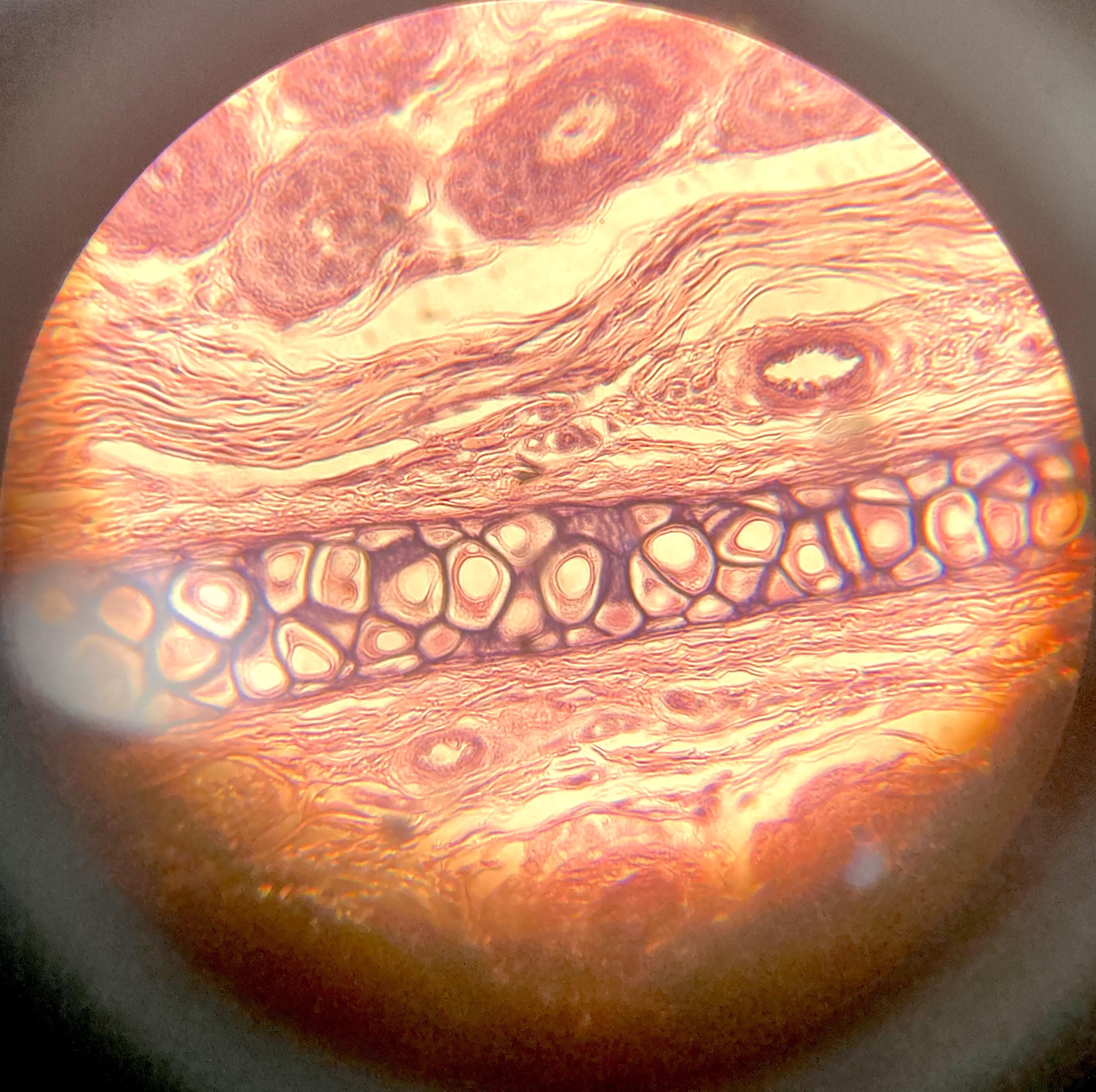 Elastic Cartilage Under A Microscope | Scrolller