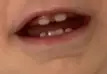 Baby has large gap between teeth 