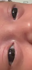 Baby’s eye colour? 