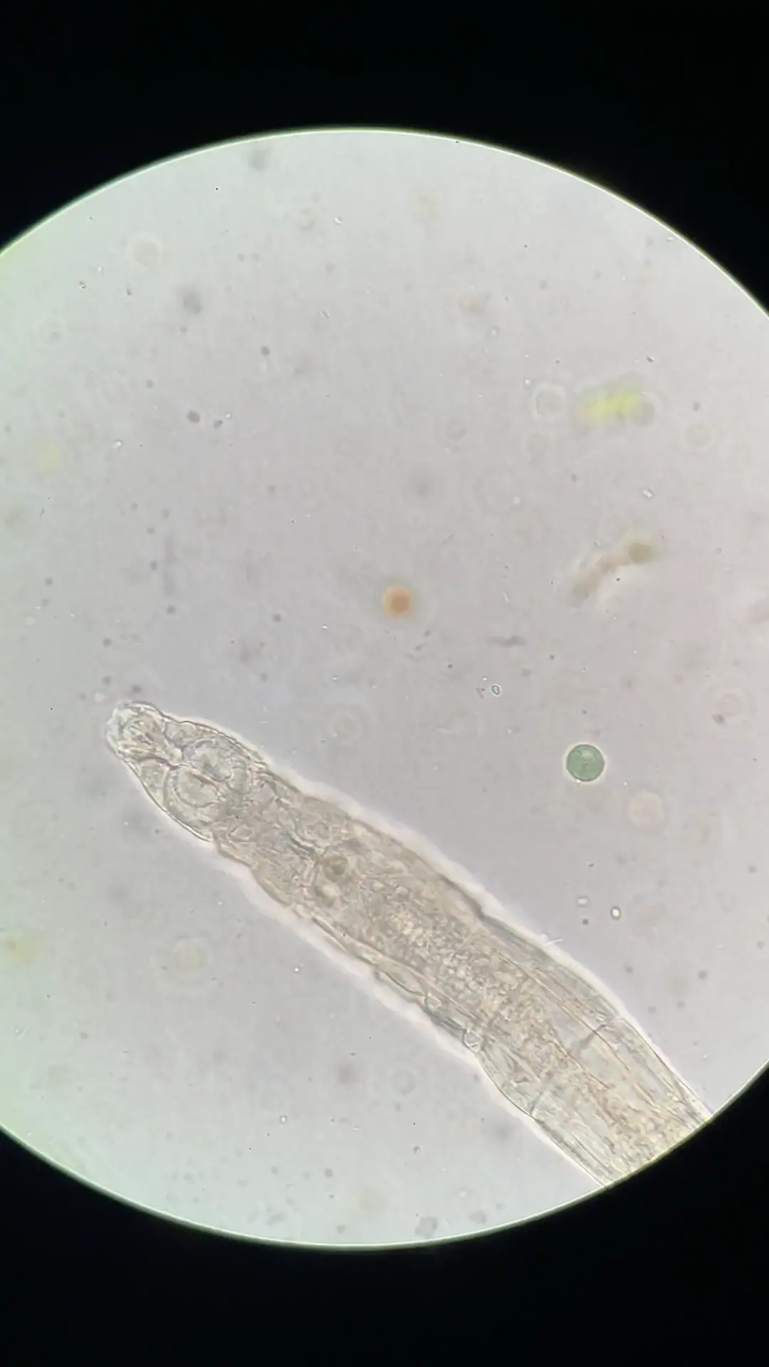 Bdelloid Rotifer eating