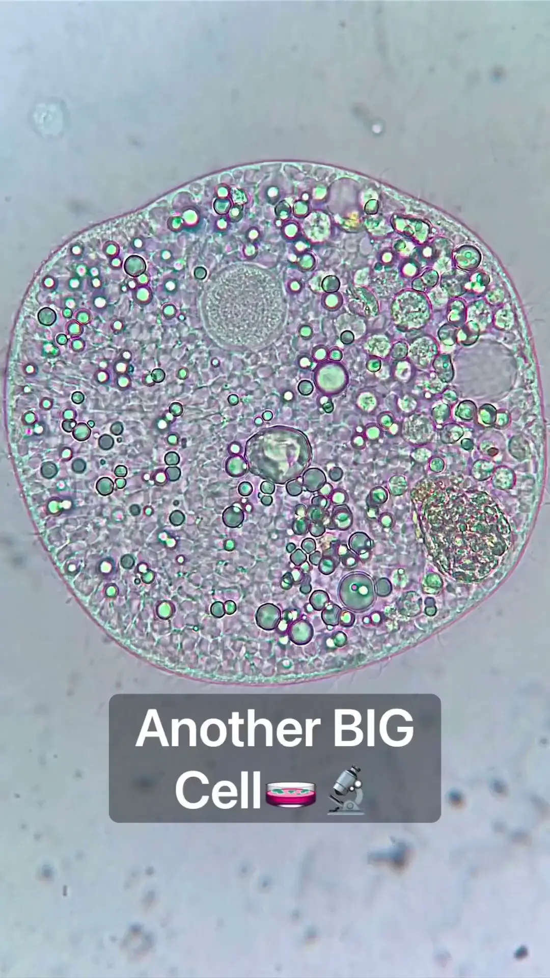 Big cell under the microscope.