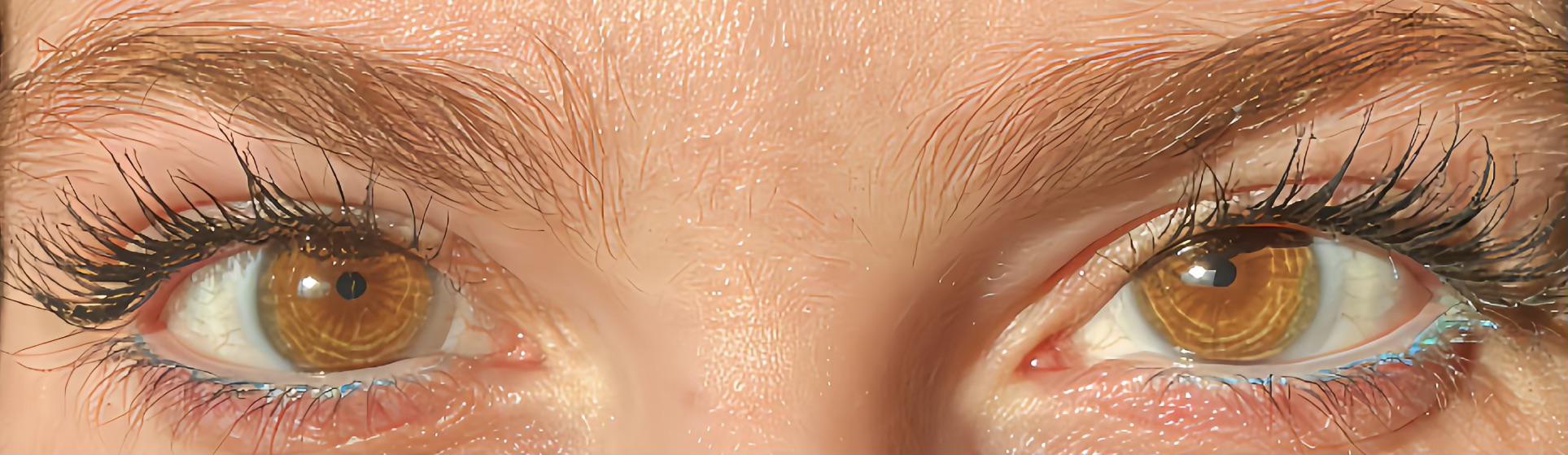 What are these rings in my eyes? I’ve never noticed them until today ...