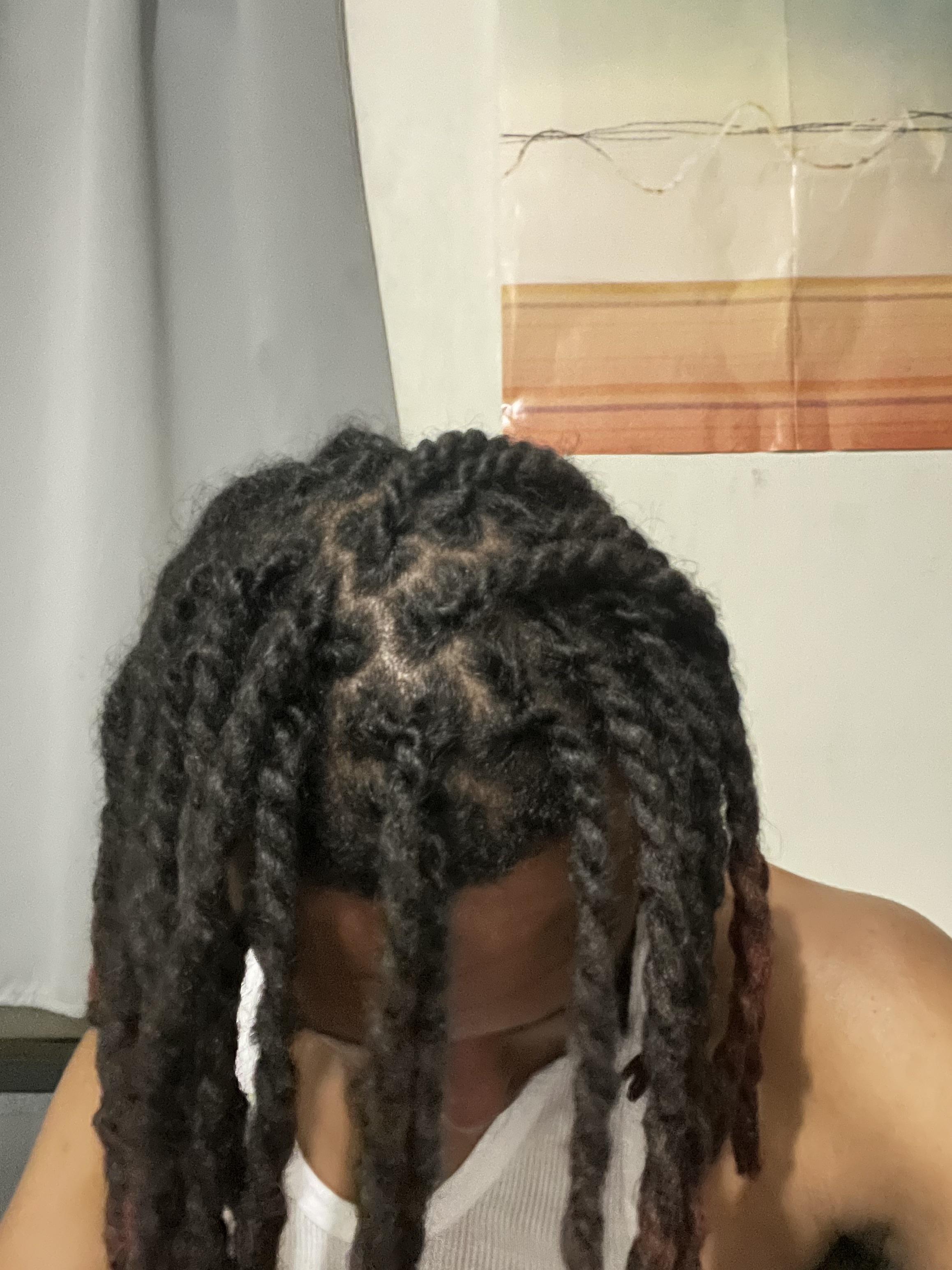 Did my retwist before and after