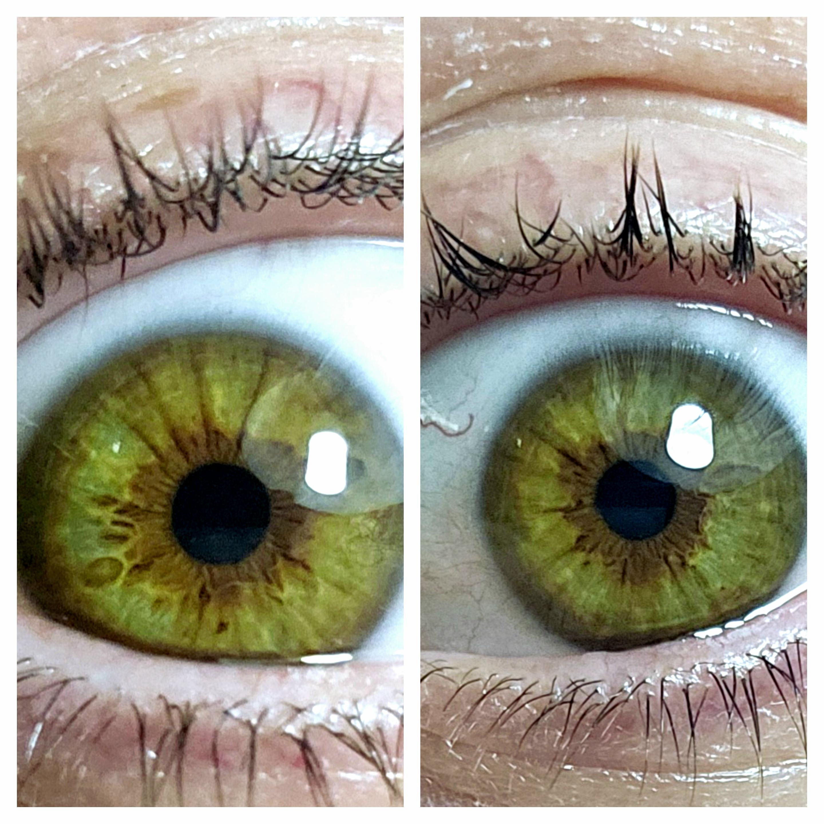 Love looking at all of the unique eyeballs on this sub! Here's my contribution. 💚🤎