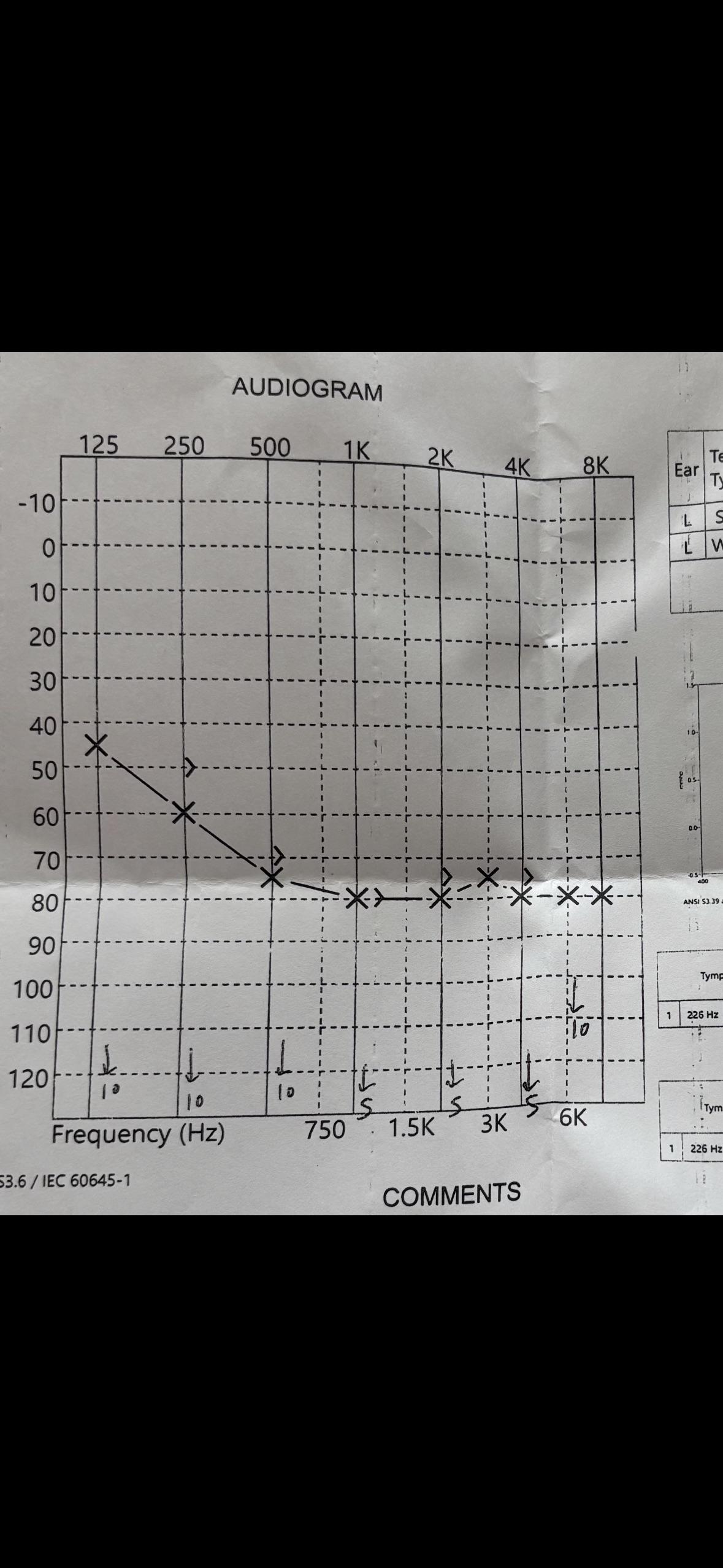 Deaf Identity With Hearing Aids