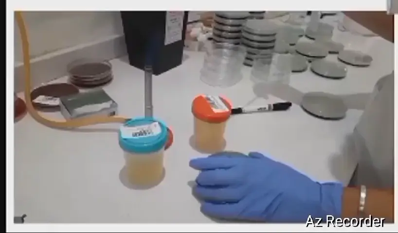 Has anyone seen or performed this type of inoculation for a urine culture?
