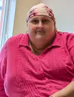 I lost my hair (chemo). Do I still resemble a woman?
