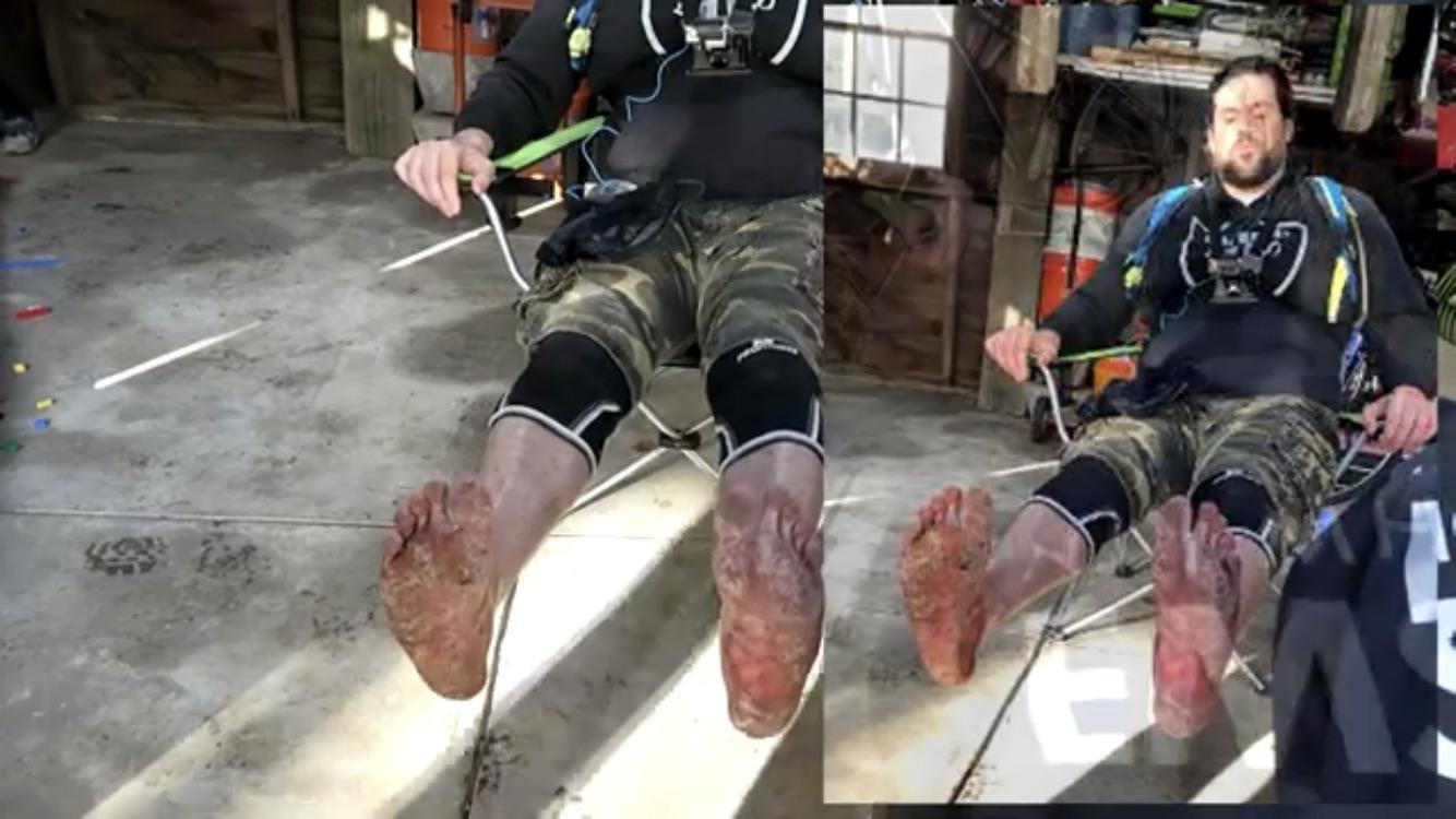 L.A. Beast’s Feet After Setting A World Record Walking 2.4 Miles Across ...