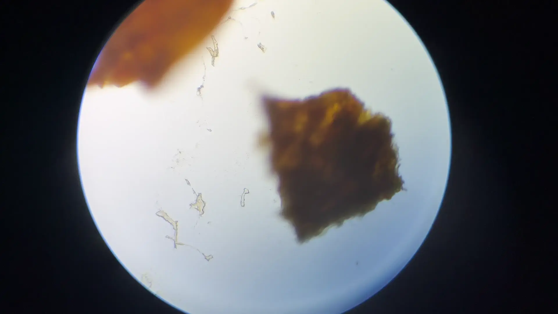 Microscope Cant Focus
