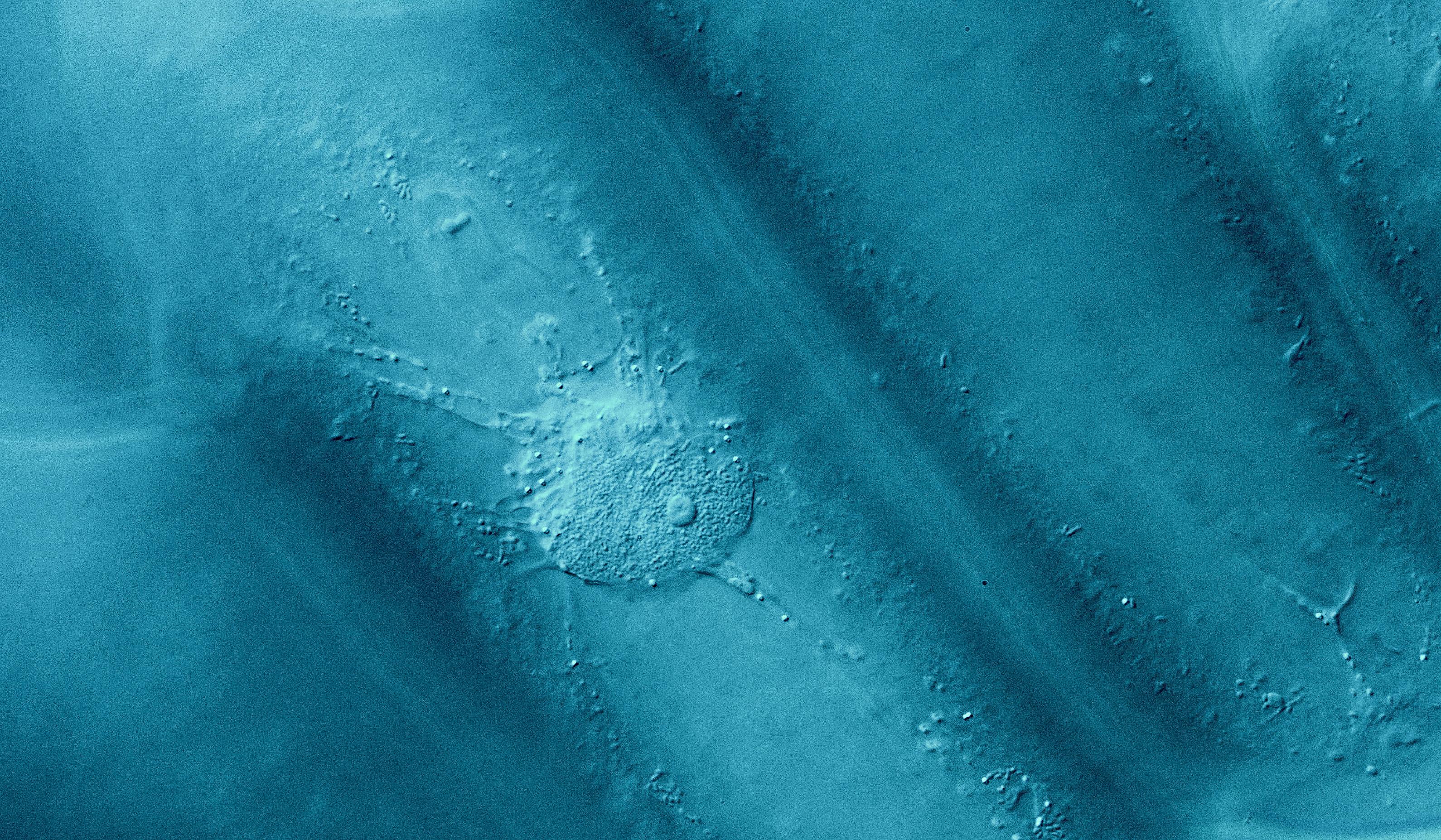 Nucleus and cytoplasm strands inside an onion cell [OC] | Scrolller