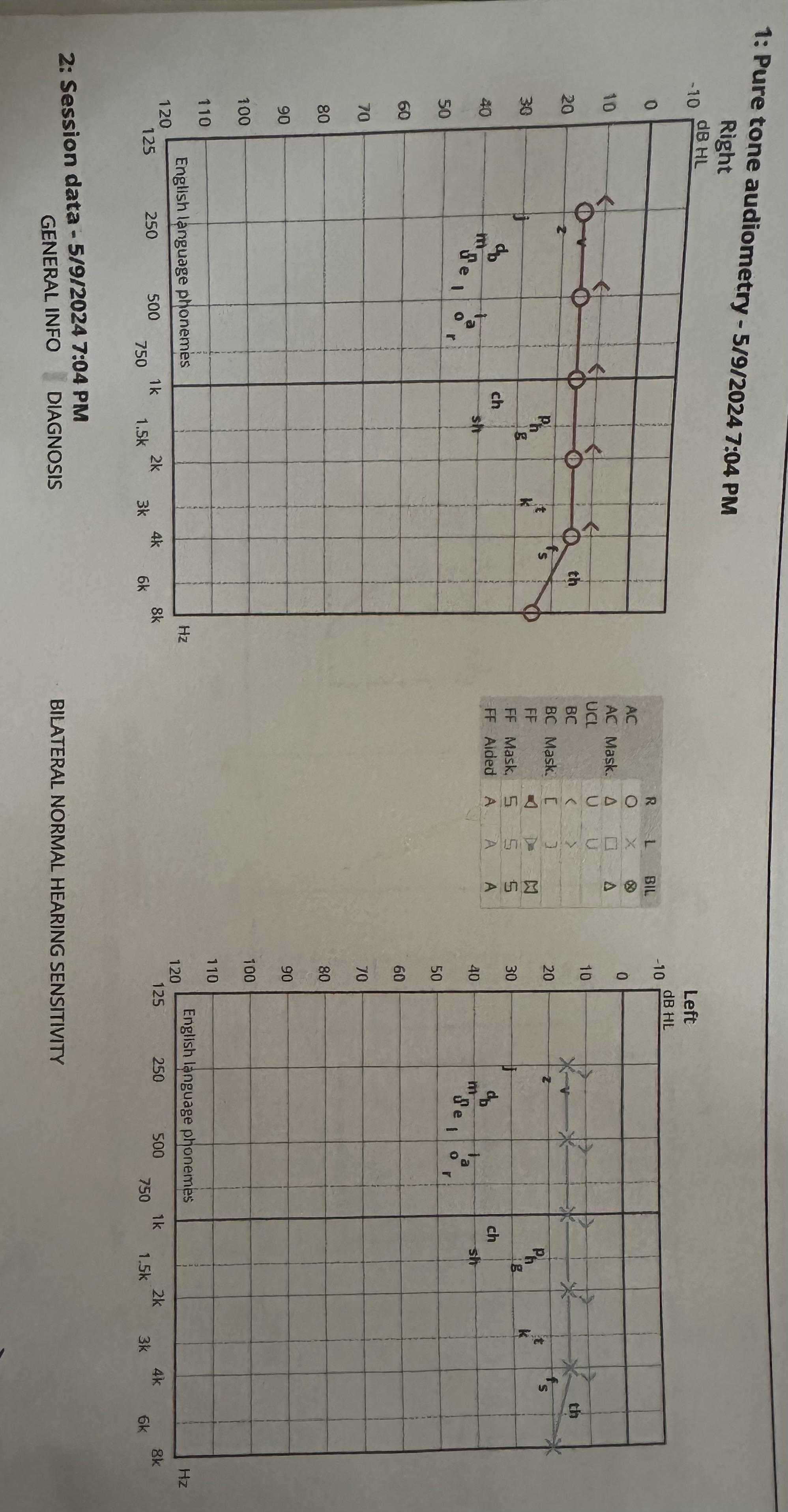 Please help me interpret my Audiogram test results | Scrolller