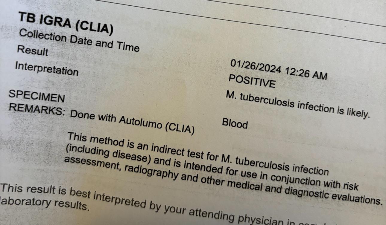 Positive for IGRA, PPD but negative for CXR | Scrolller