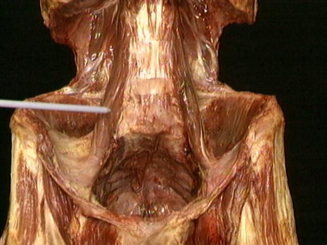 psoas-major-muscle-identified-in-the-abdomen-what-is-the-function-of-psoas-major-scrolller