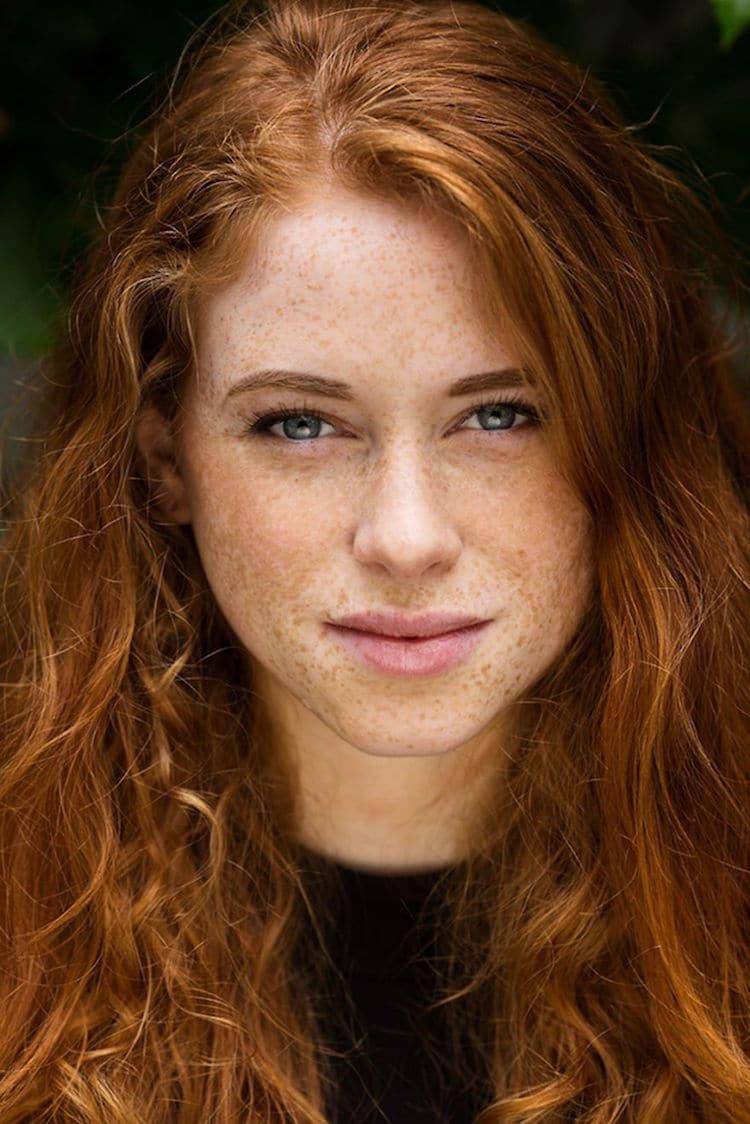 Redhead And Freckles Surprising Combination Scrolller 