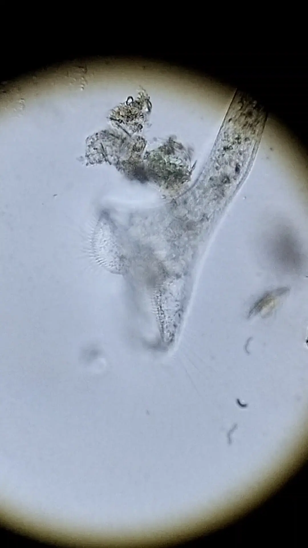 Rotifer feeding 