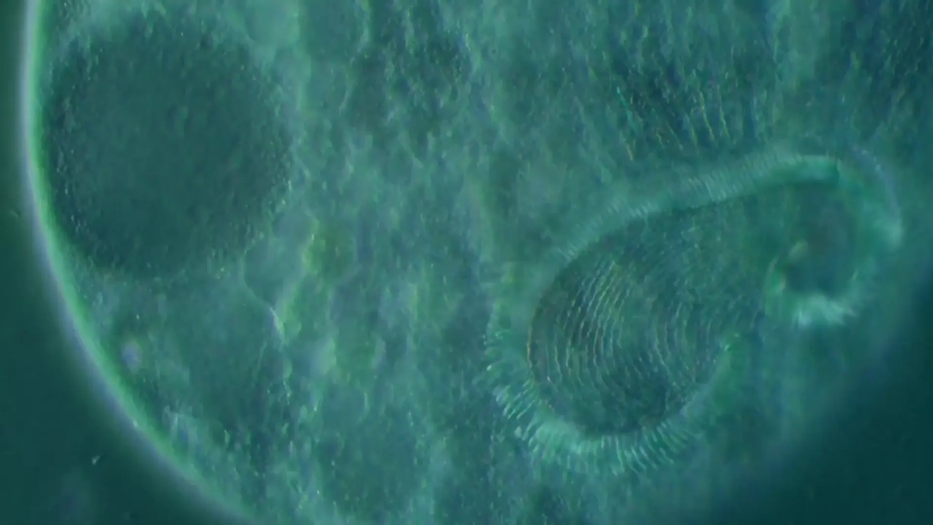 STENTOR (DIC 20X objective)