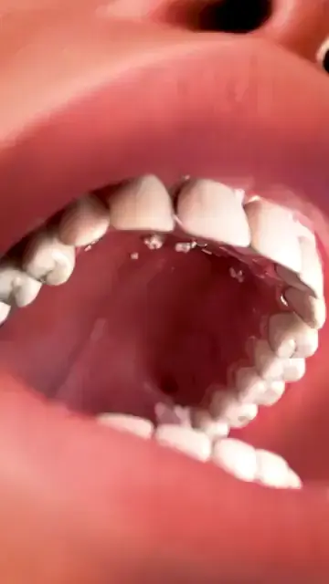 Teeths can grow in the roof of the mouth and it is called Hyperdontia! 