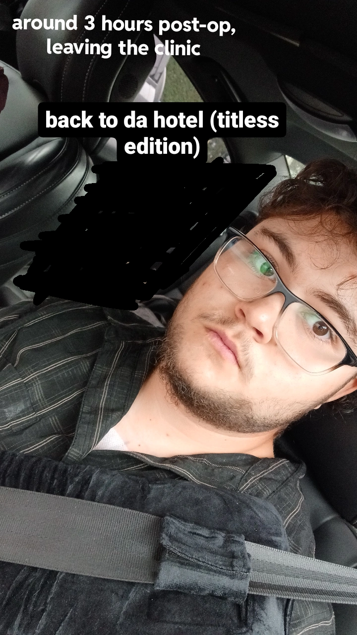 Finally got top surgery!