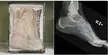 The bone structure of a human foot and an elephant foot.