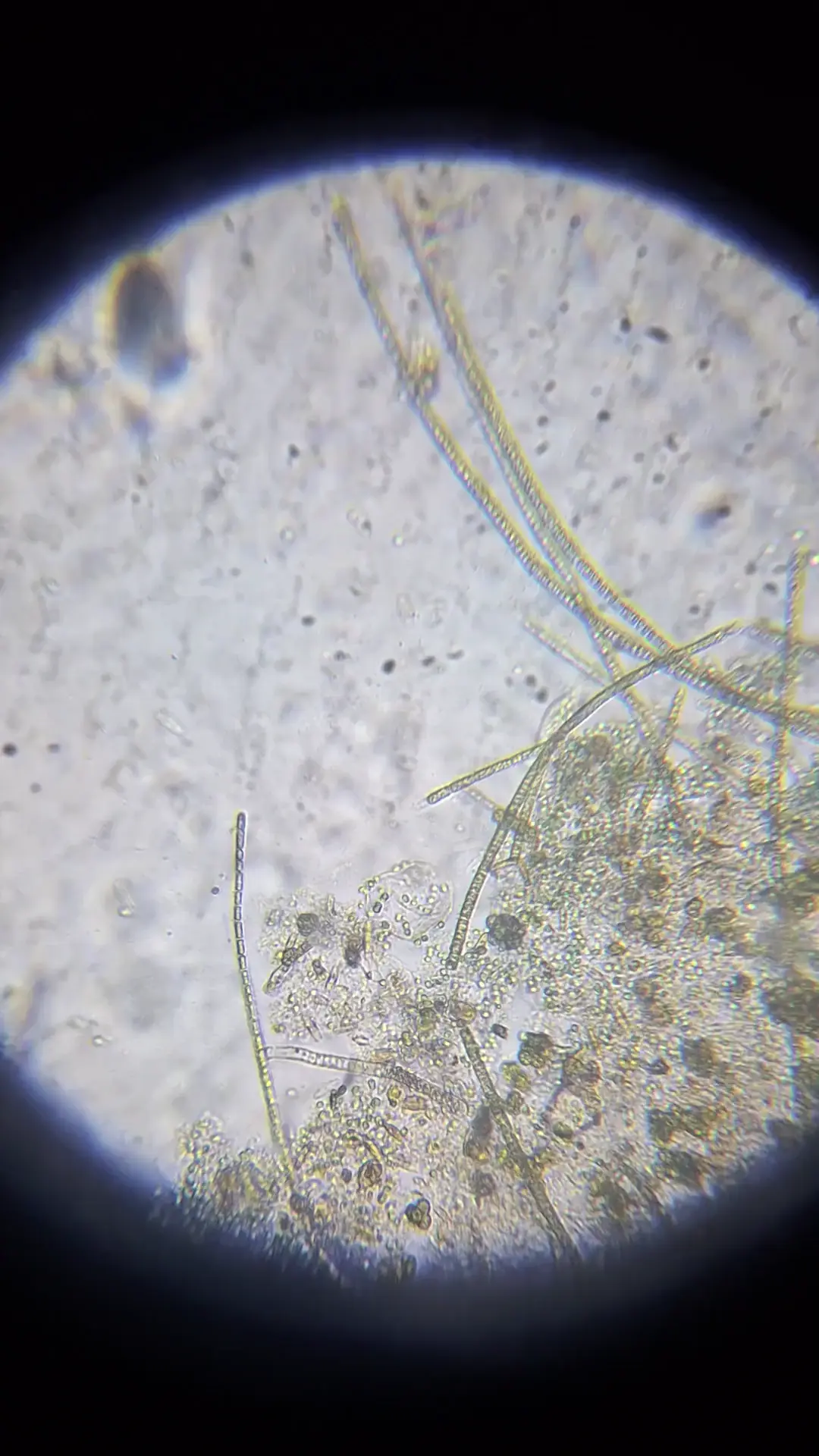 What is this worm thing