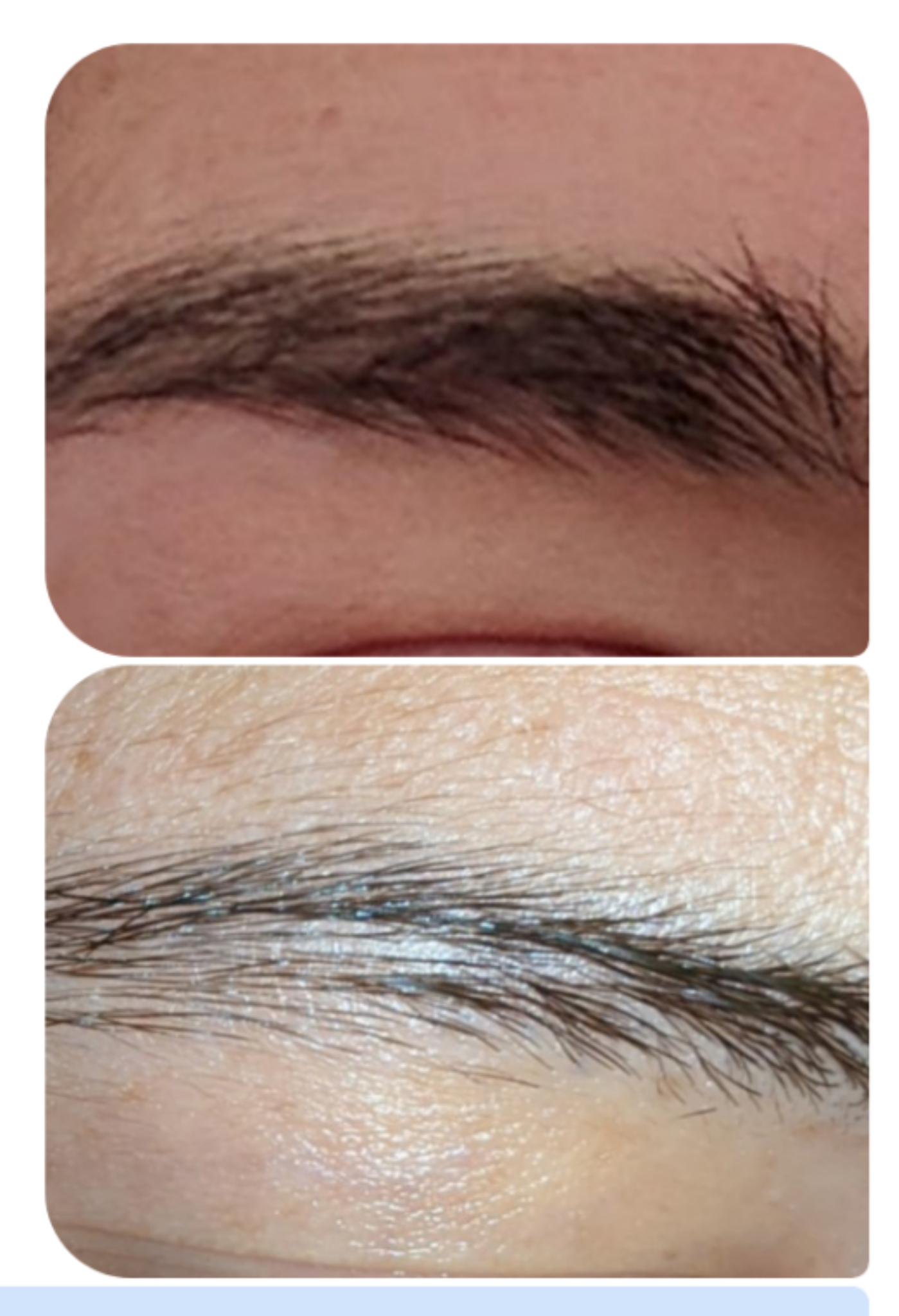 why-are-my-eyebrows-thinning-scrolller