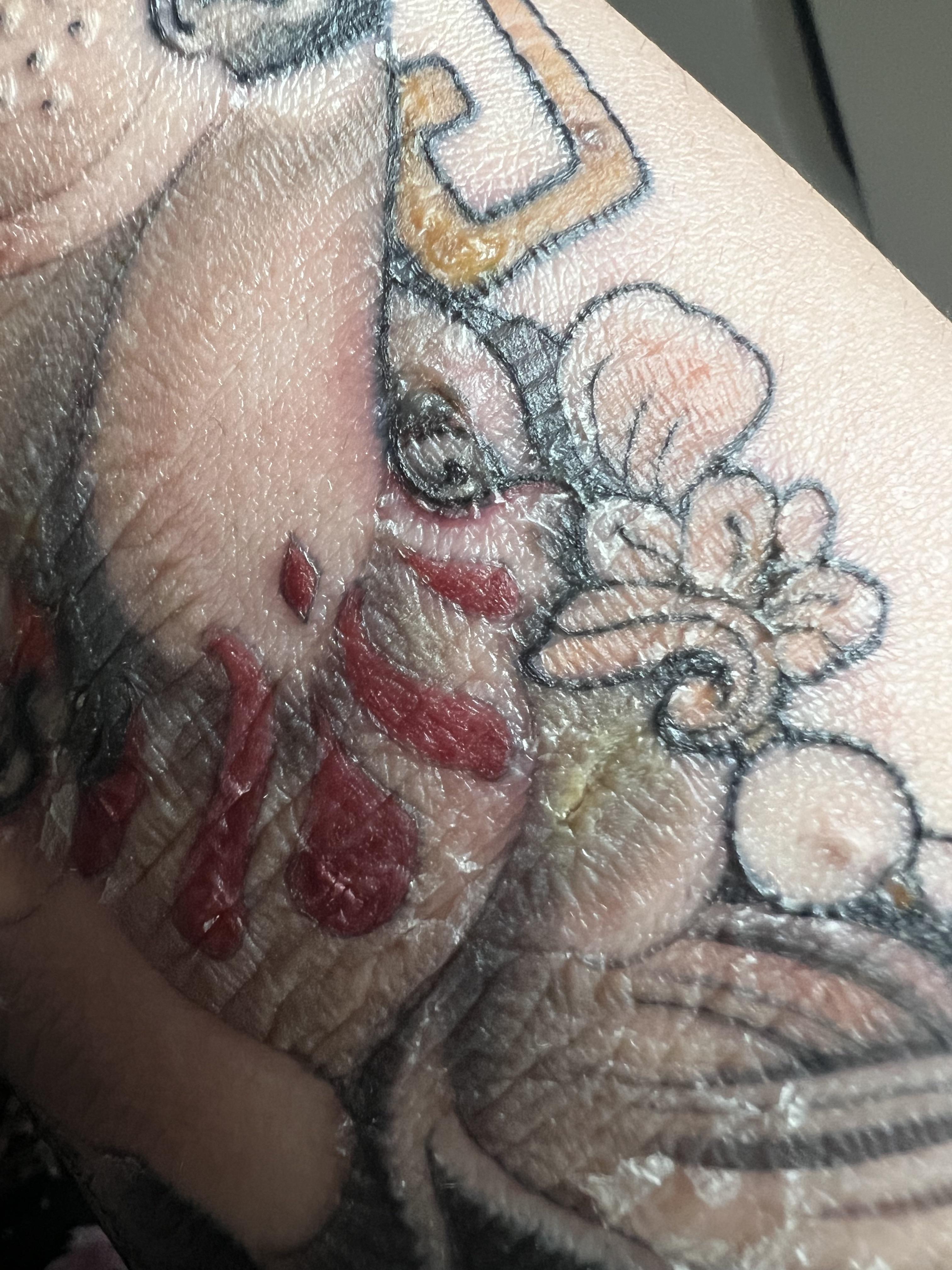 Help with new tattoo - infected?