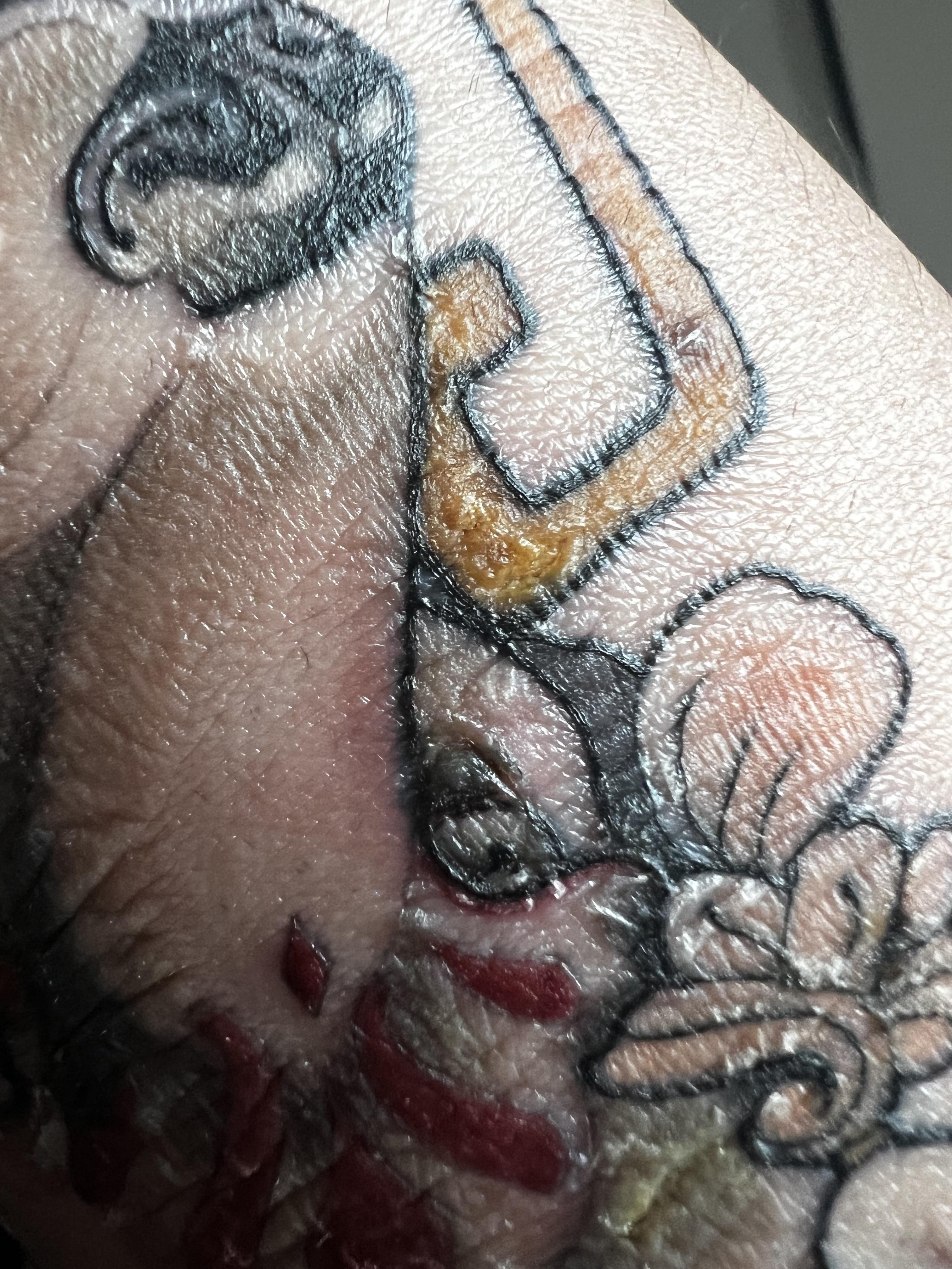 Close-up of a colorful tattoo on fair skin with redness and irritation