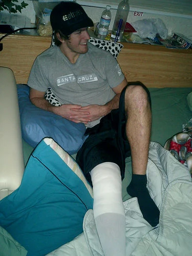 Kyle, acl surgery