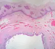Vagina (1)
