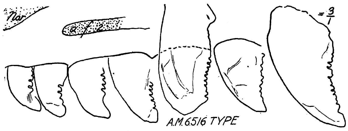 Maxillary teeth