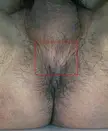 Close-up of a tanned person's perineum and dark pubic hair