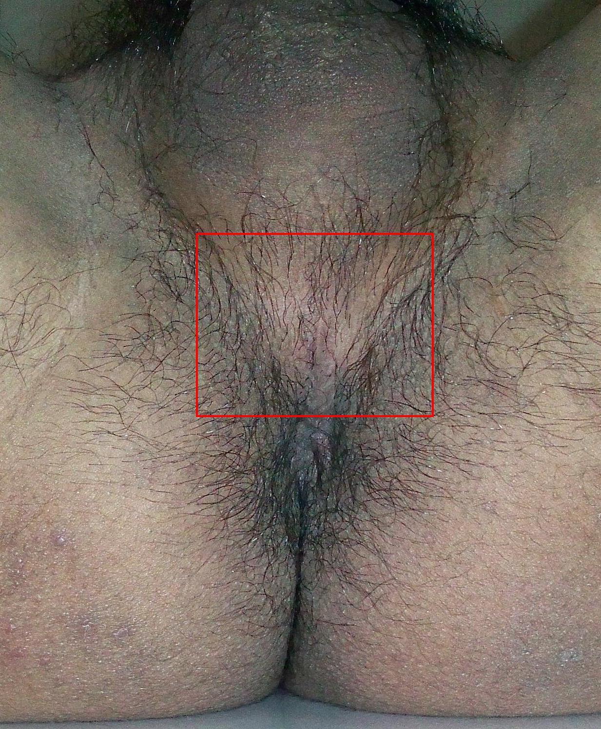 Perineum